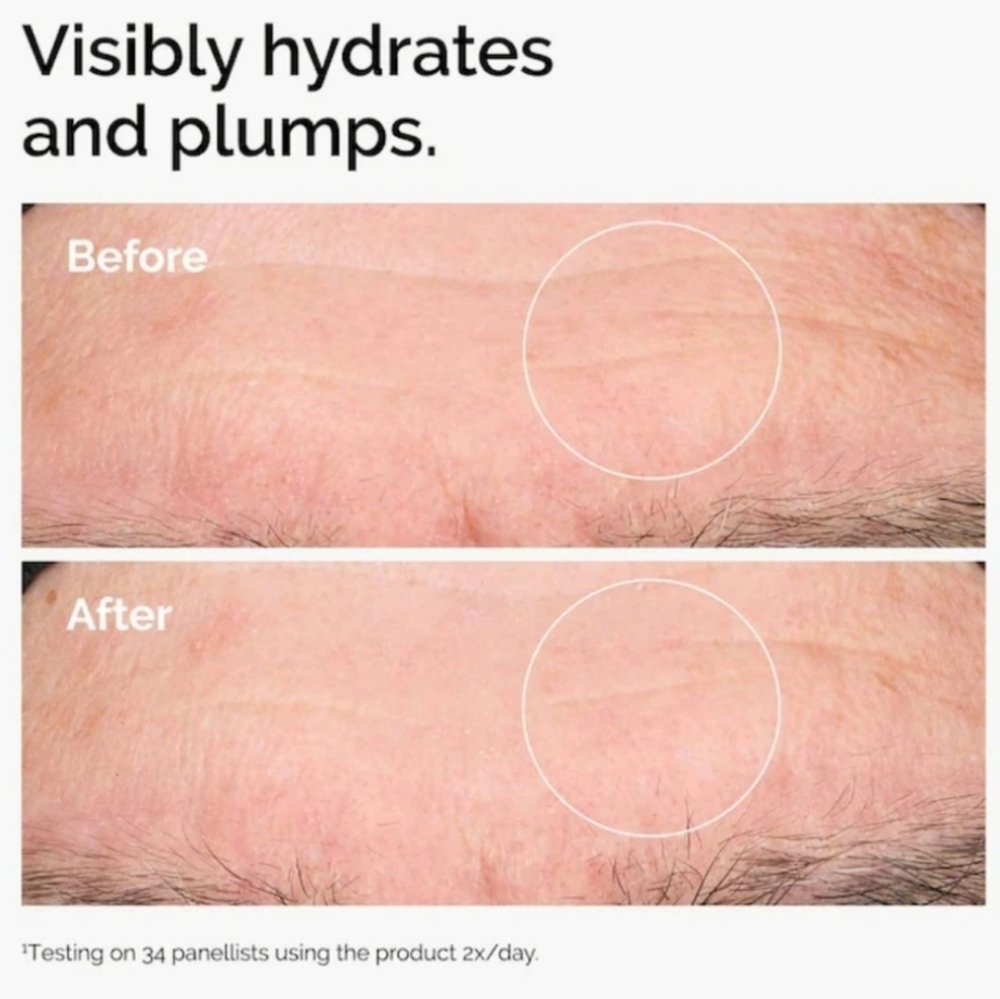 Hyaluronic Acid + B5 Hydrating Serum with Ceramides 30ml A3, The Ordinary - Picture 3 of 5